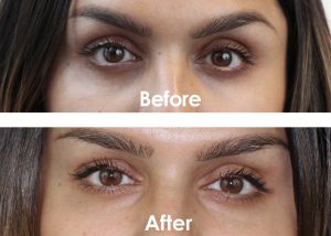 risultati delle utilizzatrici di Kiehl's Creamy Eye Treatment with Avocado